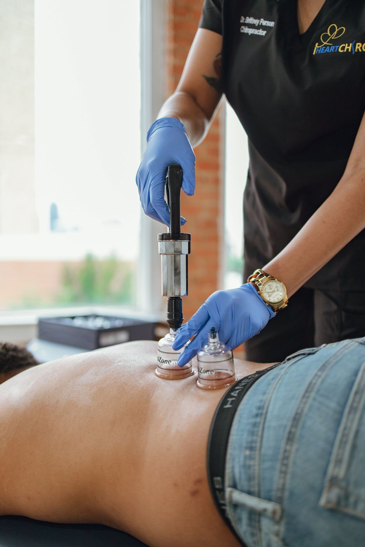 Cupping